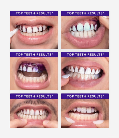 Brightsy's PAP+ Whitening Strips